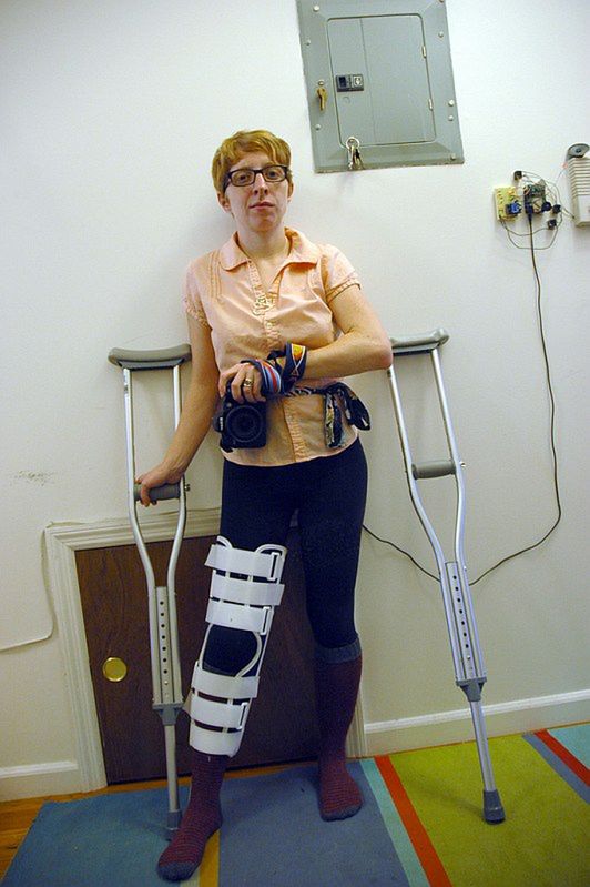 Proteza na operowanym kolanie 