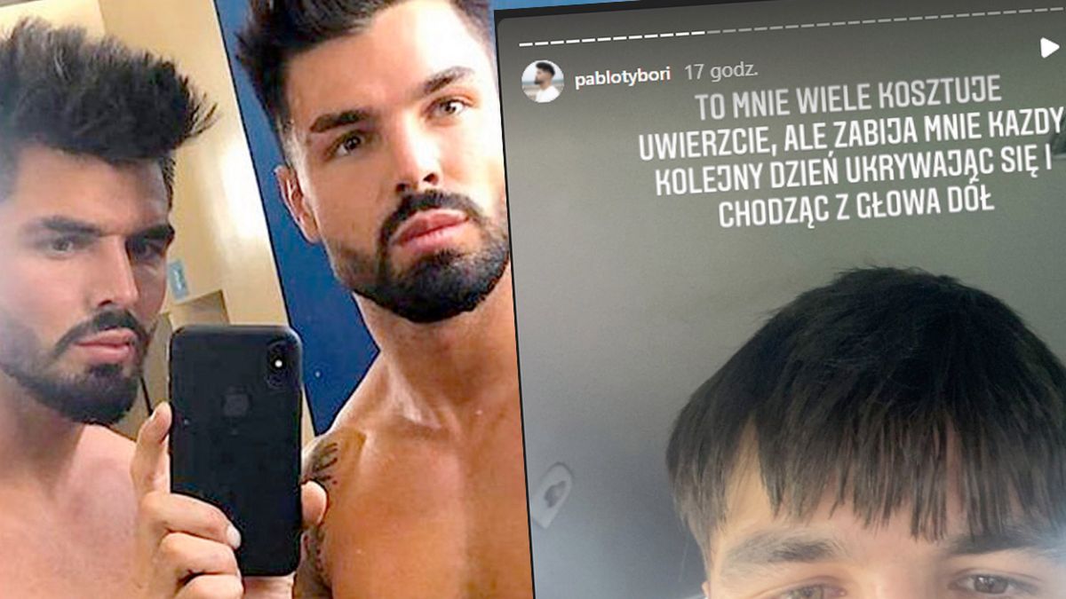 To straszne, jak Paweł z "Love Island" OSZPECIŁ się serią zabiegów. Przystojniak jest załamany: "Moja twarz już nie wróci do normalnego stanu"