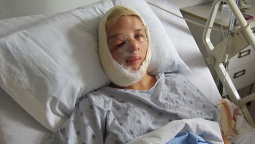 Sarah Atwell, nastoletnia bohaterka filmu "Dziewczyna z połową twarzy"