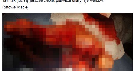 Ratownik pokazał, co ratował w Sylwestra. "Robią sobie konfetti z kończyn"