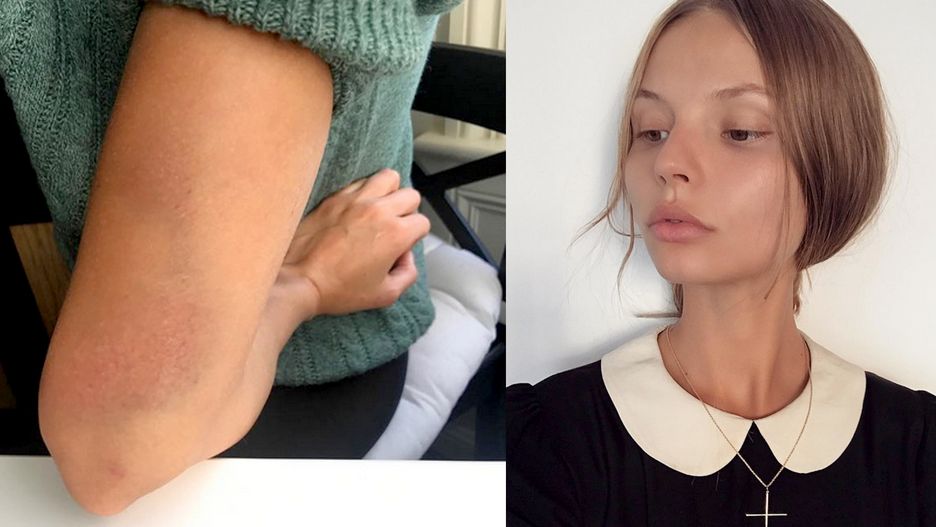 Magdalena Frąckowiak została napadnięta
