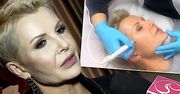 Joanna Racewicz bez ogródek przyznała się do licznych zabiegów na twarz: "Zastanawiam się skąd takie emocje" [WIDEO]