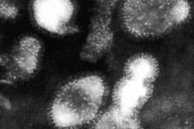 Ptasią grypę powoduje śmiertelny wirus H5N1