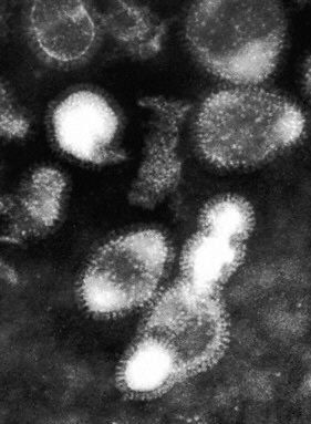 Ptasią grypę powoduje śmiertelny wirus H5N1