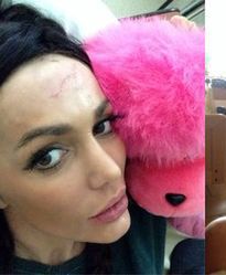 Orzechowska jeździ na wózku! Spędzi w szpitalu jeszcze pół roku!