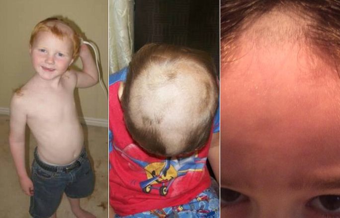 Dzieci kontra nożyczki. Teraz jest żal