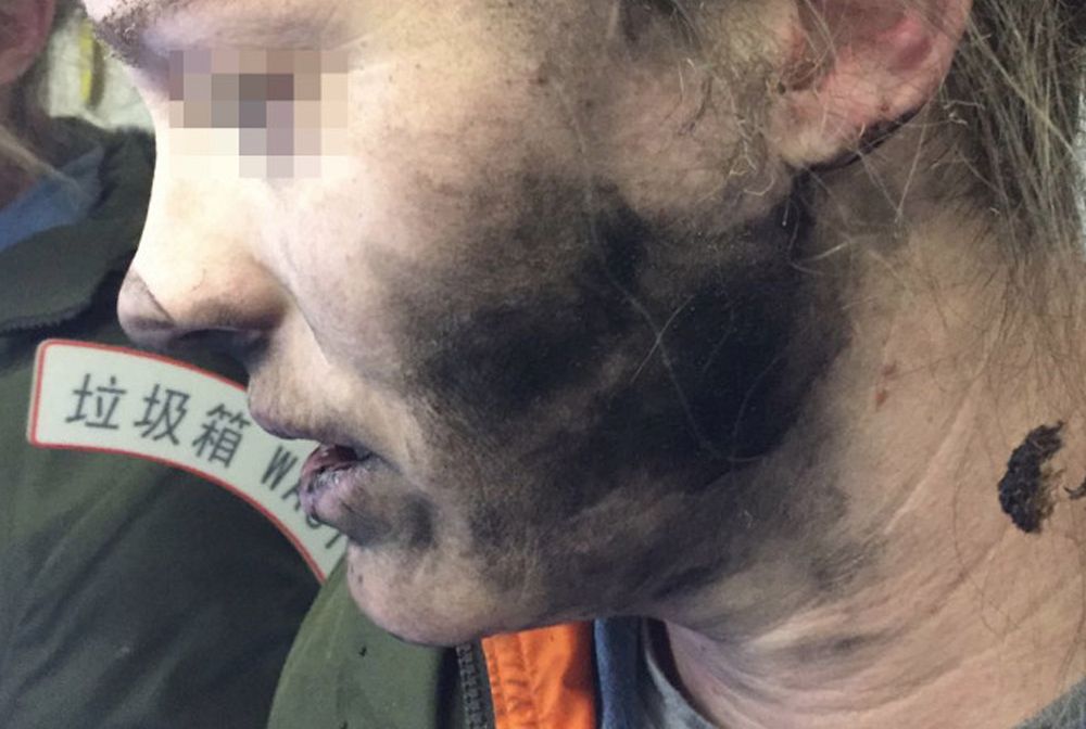 Słuchawki wybuchły jej na głowie. Panika w samolocie