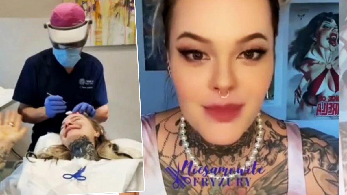 Monika Miller zdradziła, że w wyniku choroby łysieje. Poddała się kosztownemu zabiegowi. Pokazała relację z przeszczepu w klinice