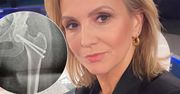 Marta Kuligowska miała wypadek. Już po prześwietleniu widać, że sprawa jest poważna. "Nie piszcie, że przez sport do kalectwa"