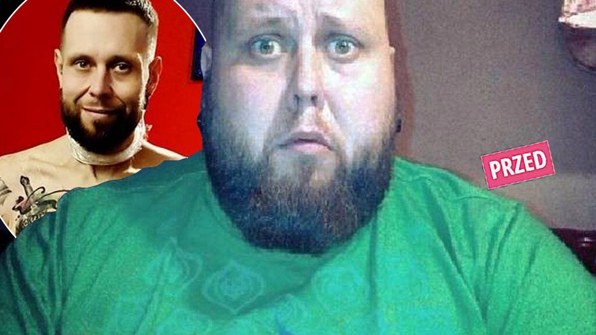 Odchudzony o 160 kg Mateusz z „Gogglebox” pokazał się bez koszulki. Hejterzy komentują zwisającą skórę na brzuchu