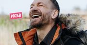 Kossakowski wstrzyknął sobie botoks i powiększył usta. To nie koniec zabiegów, którym się poddał. Pokazał zdjęcie nowej twarzy