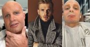 Gwiazdy pracują w ekstremalnych warunkach na planie "TTBZ". Ciachorowski pokazał, jak wpłynęło to na jego twarz
