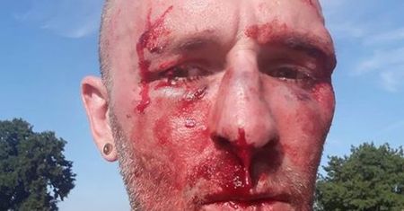 Pobicie dziennikarza Przemysława Witkowskiego we Wrocławiu. Oskarżony: To ja jestem ofiarą