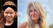 Martyna Wojciechowska zdradza jedyną wadę Kabuli. Jej adoptowana córka jest NIEMAL idealna?