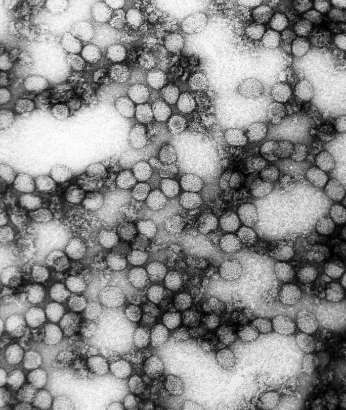 Mikroskopowy obraz wirusa żółtej febry 