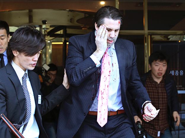 Atak na ambasadora USA w Korei Południowej. Mark Lippert przeszedł operację