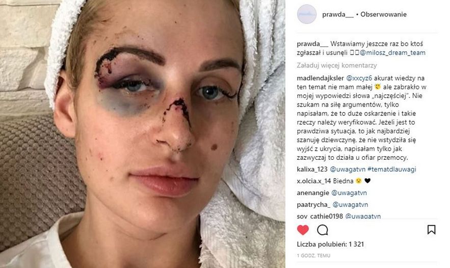 Katarzyna pokazała zmasakrowaną twarz w sieci