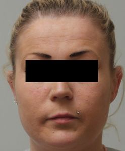 Polka podejrzana o otrucie staruszka. Policja szuka innych pracodawców