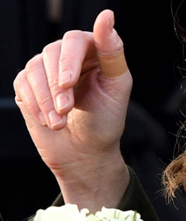 Księżna Kate z plastrem ochronnym na palcu