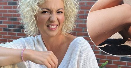 Dorota Szelągowska pokazała z bliska poznaczone rozstępami uda. Nie ukryła, co myśli o tym defekcie skóry