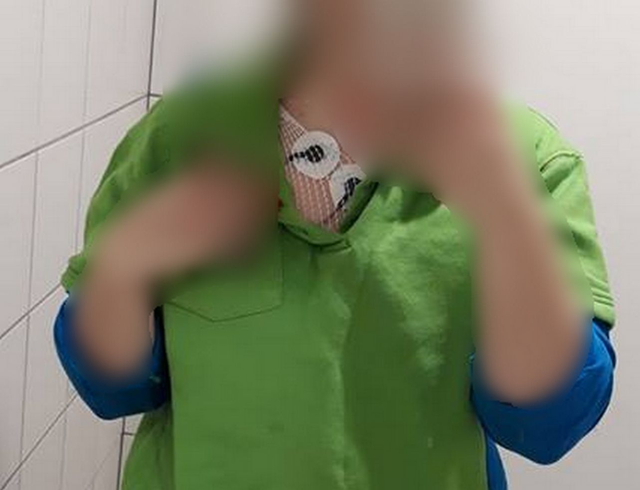 Jedna z pracownic Biedronki sfotografowała elektrody holtera, który założono jej w pracy