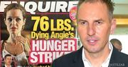 Doktor Krzysztof Gojdź komentuje szokujące zdjęcia Angeliny Jolie: "Podstawą powinno być leczenie psychiatryczne..."