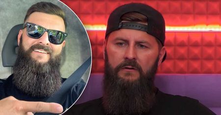Radek z Big Brothera pokazał zmasakrowany palec po wypadku! Zdjęcie tylko dla osób o mocnych nerwach