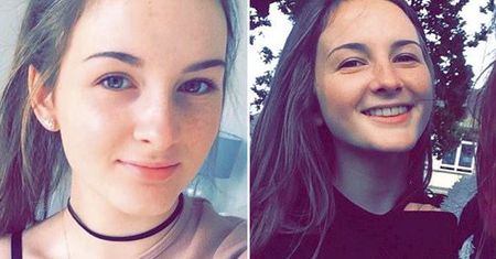 Oblała koleżankę kwasem i oszpeciła na całe życie. Poszło o chłopaka