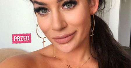Marietta z "Hotelu Paradise" przeszła operację plastyczną. Poprawiła sobie nos
