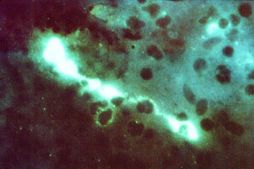 Zdjęcie bakterii Chlamydia psittaci