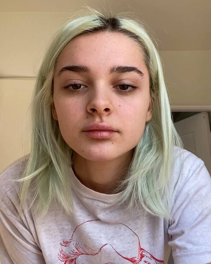 Charlotte Lawrence ma koronawirusa