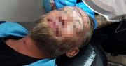 Tomek za pieniądze zrobił na czole tatuaż. Teraz chce, by winni trafili do więzienia