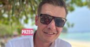 Rafał Mroczek przeszedł operację plastyczną. "Ale się w głowie przewraca" komentują fani