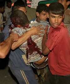 15 rannych po izraelskim ataku
