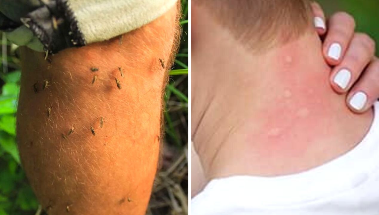 Kolory, które przyciągają komary, kleszcze i muchy. Ubrań w tych barwach unikaj, dzięki temu ocalisz własną skórę
