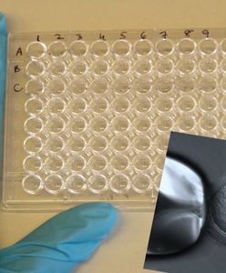 Fatalna pomyłka kliniki in vitro. Wstrzykiwała kobietom spermę obcego mężczyzny