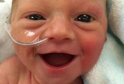 "Cieszy się, że żyje". Uśmiechnięty wcześniak podbija serca internautów