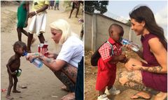 To zdjęcie wstrząsnęło światem. Wolontariuszka pokazała, jak dziś wygląda 2-latek skazany za czarownictwo