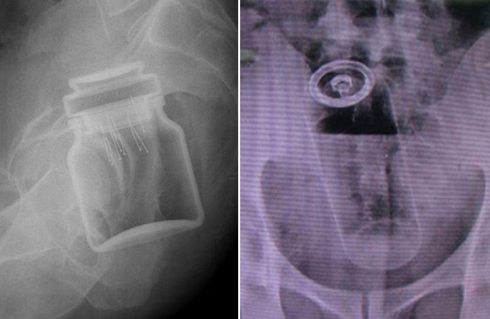 Poszli z tym do lekarza. Niewiarygodne, jak się tłumaczyli