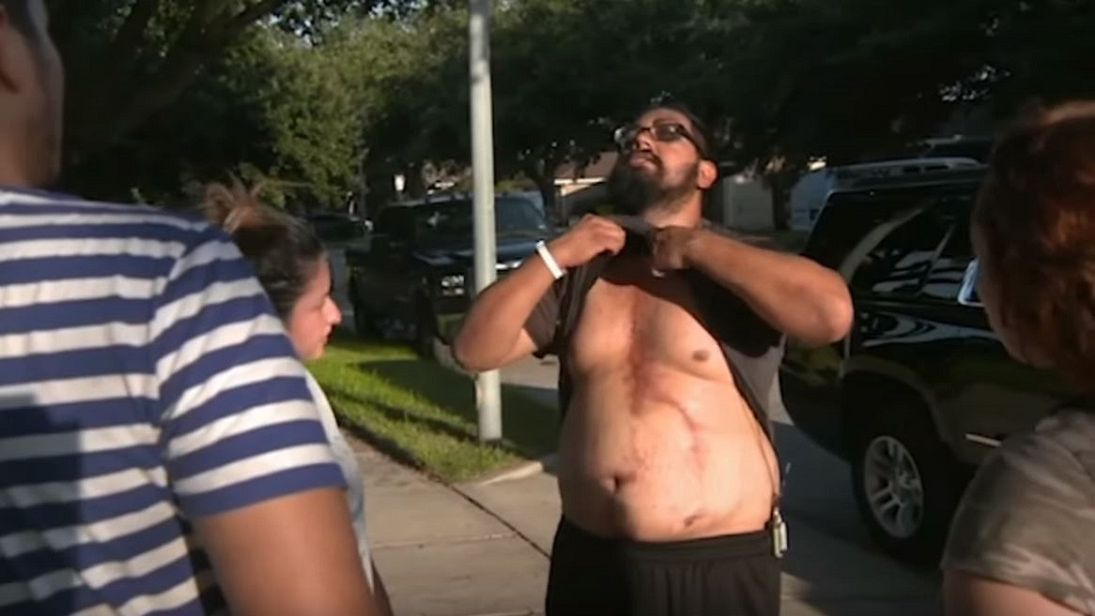 27-latkowi z Teksasu pozostały po porażeniu piorunem ślady na całym ciele.