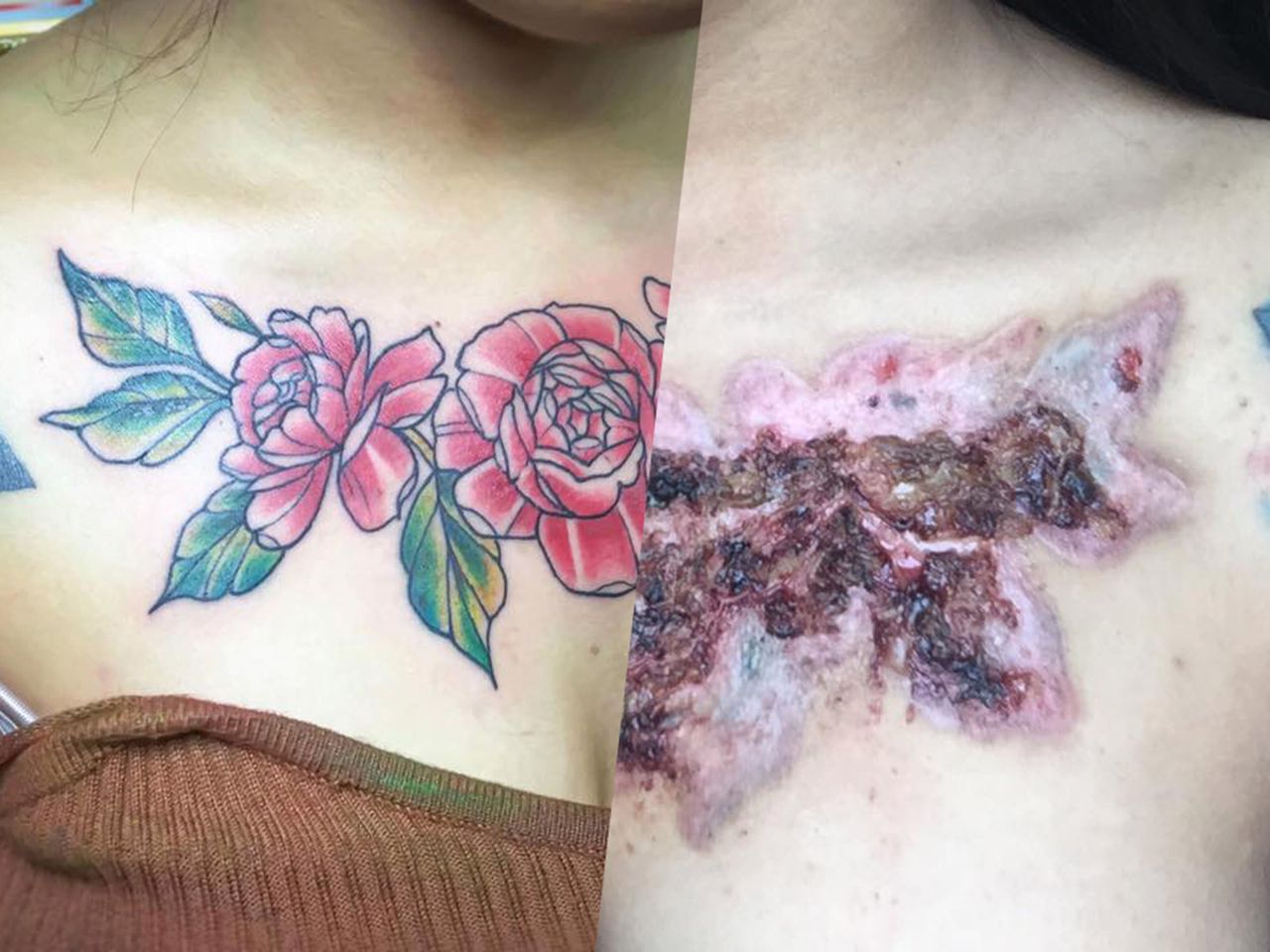 Chciała pozbyć się tatuażu. Przeszła prawdziwe piekło