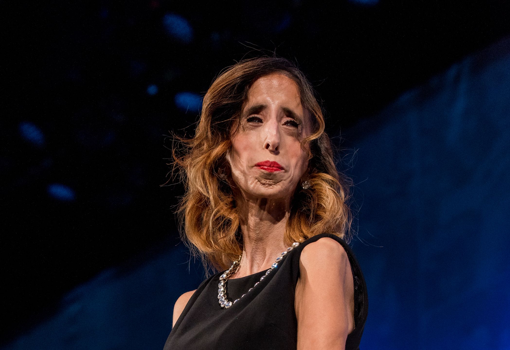 Lizzie Velasquez cierpi na rzadką chorobę