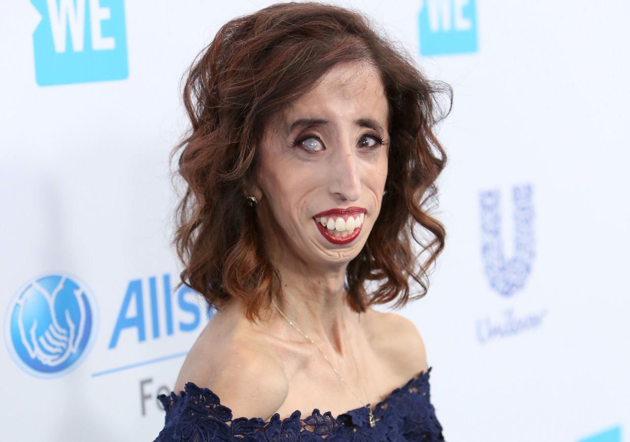 Lizzie Velasquez pokazała zdjęcie z przeszłości. Zwróciła uwagę na swój makijaż