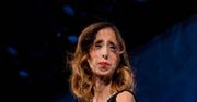Lizzie Velasquez słyszy na swój temat przykre komentarze. Aktywistka trafiła do szpitala