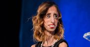 Lizzie Velasquez została nazwana "przerażającą". Teraz ma ważne przesłanie do wszystkich
