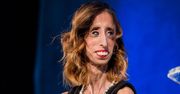 Lizzie Velasquez potrafi dostrzec w sobie piękno. Aktywistka mówi, co w sobie lubi