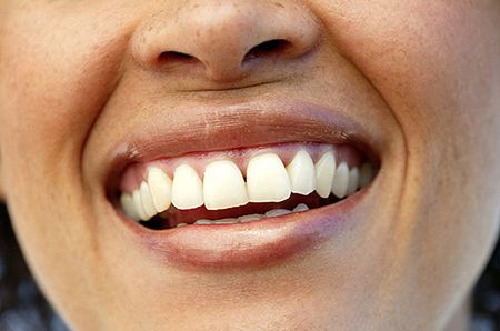 Co można zamknąć w środku sztucznego zęba?