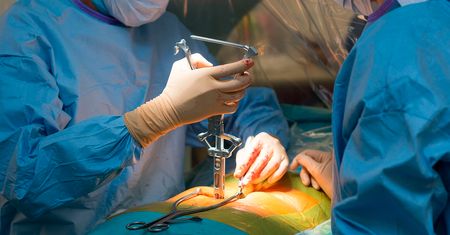 Rak go unieruchomił. Włoch stanął na nogi po przełomowej operacji
