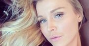 Joanna Krupa jak Kim Kardashian. Robi sobie bolesny zabieg i pokazuje zdjęcie