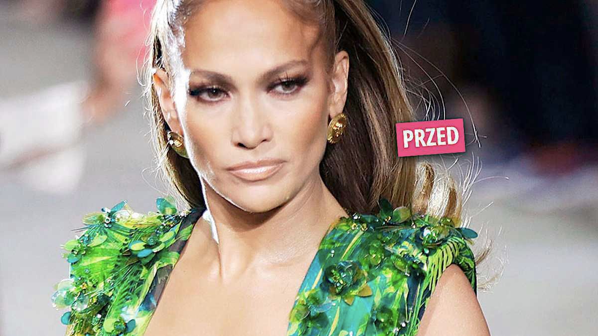 Jennifer Lopez zoperowała nos?